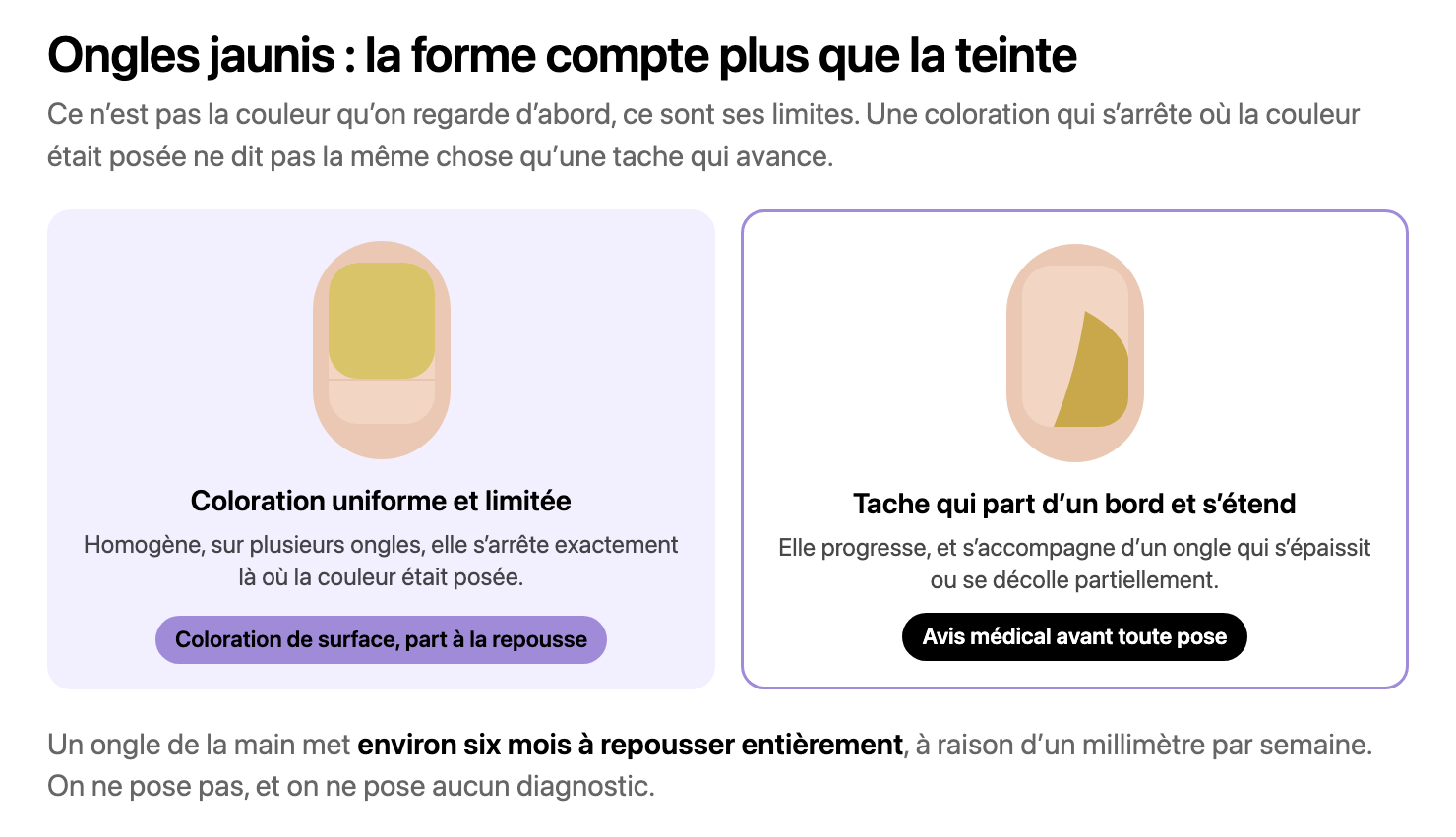 Deux tablettes dessinées : à gauche une coloration jaune uniforme qui s’arrête net avant le bord libre, à droite une tache jaune qui part du bord latéral et remonte vers la matrice. Verdicts : coloration de surface, et avis médical avant toute pose
