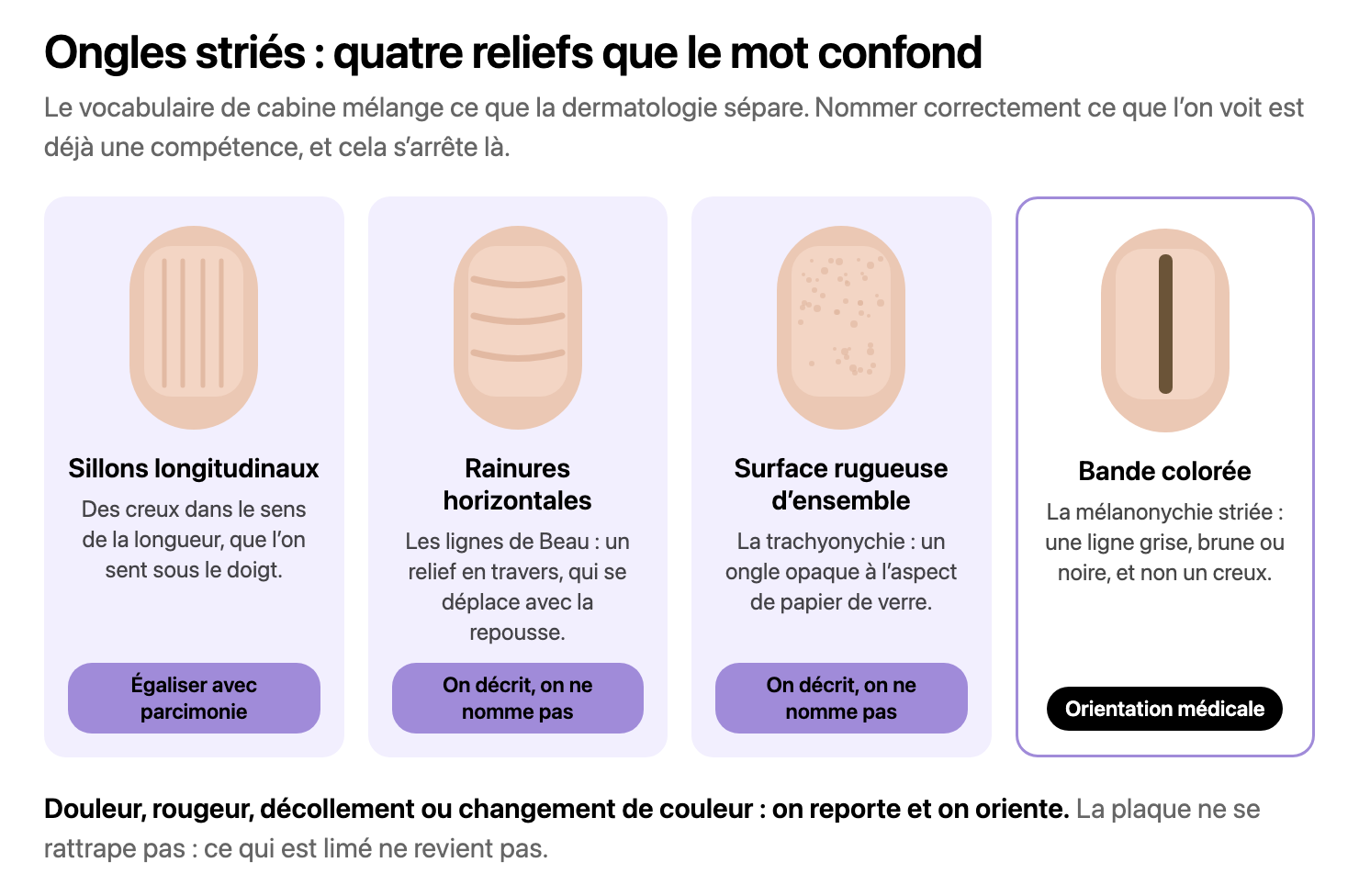 Quatre tablettes dessinées : sillons dans la longueur, rainures en travers, surface piquetée façon papier de verre, et une bande brune verticale. Sous chacune, le verdict : égaliser avec parcimonie, décrire sans nommer, et orientation médicale